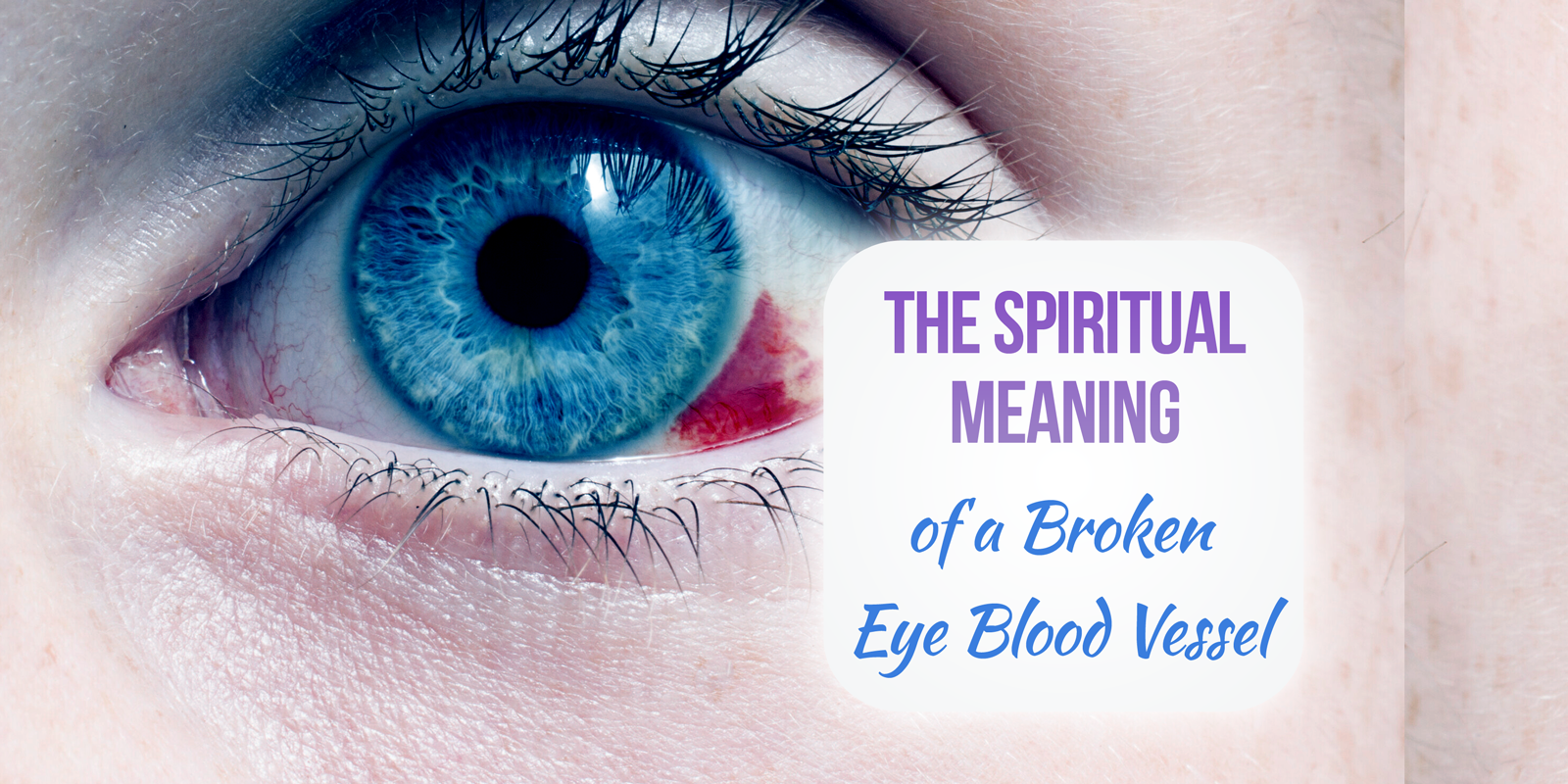 broken-blood-vessel-eye-spiritualism