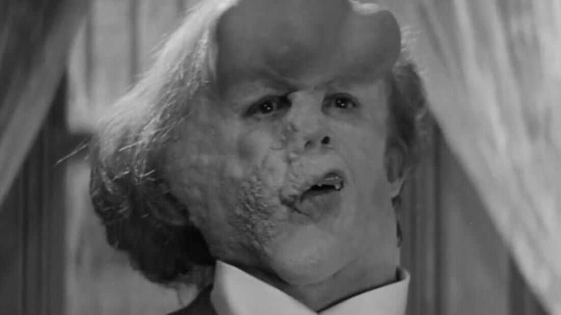 John Merrick (The Elephant Man)